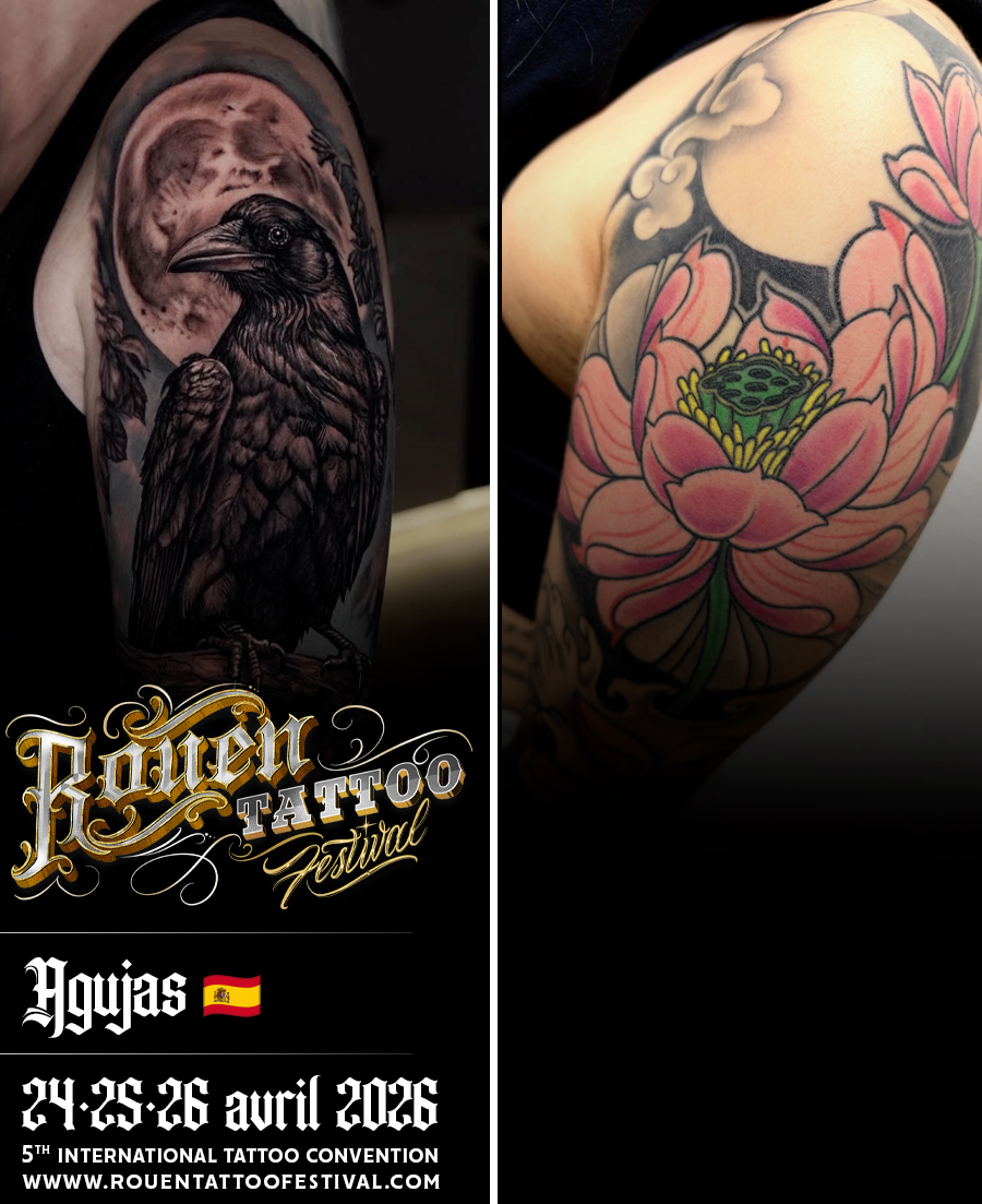 agujas2